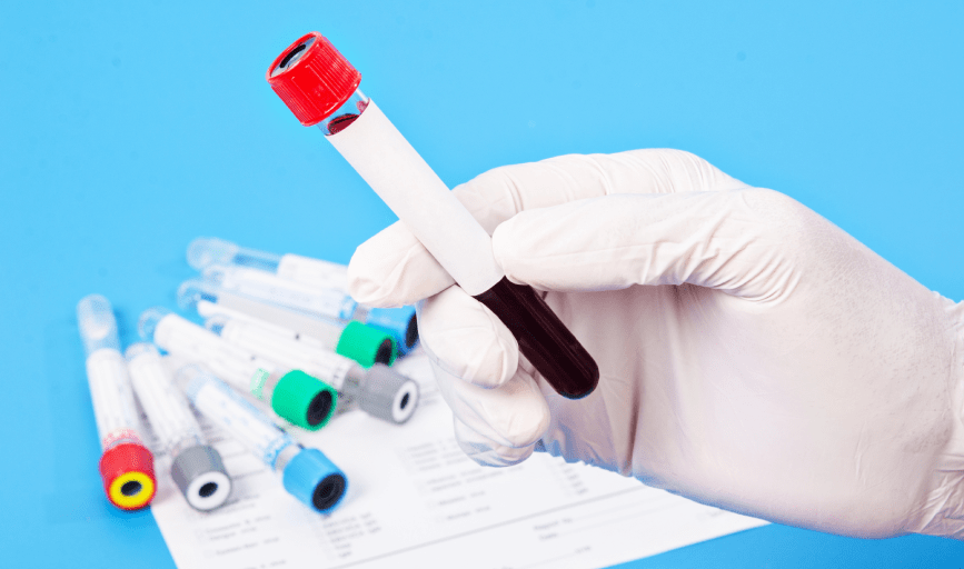 LABORATORY SAMPLE DELIVERY